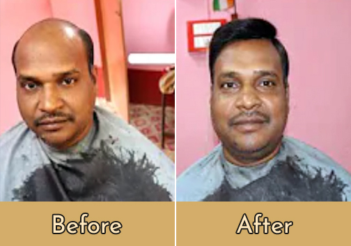 Hair Wigs Manufacturer in Kolkata