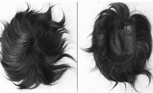 Hair Patch Price in Kolkata